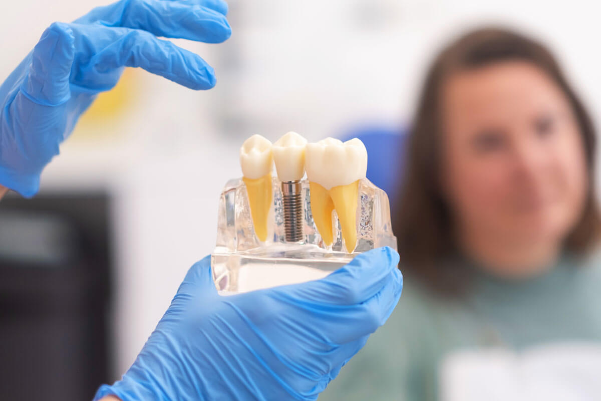 Dental Implants: Your Guide to a Permanent Solution for Missing Teeth
